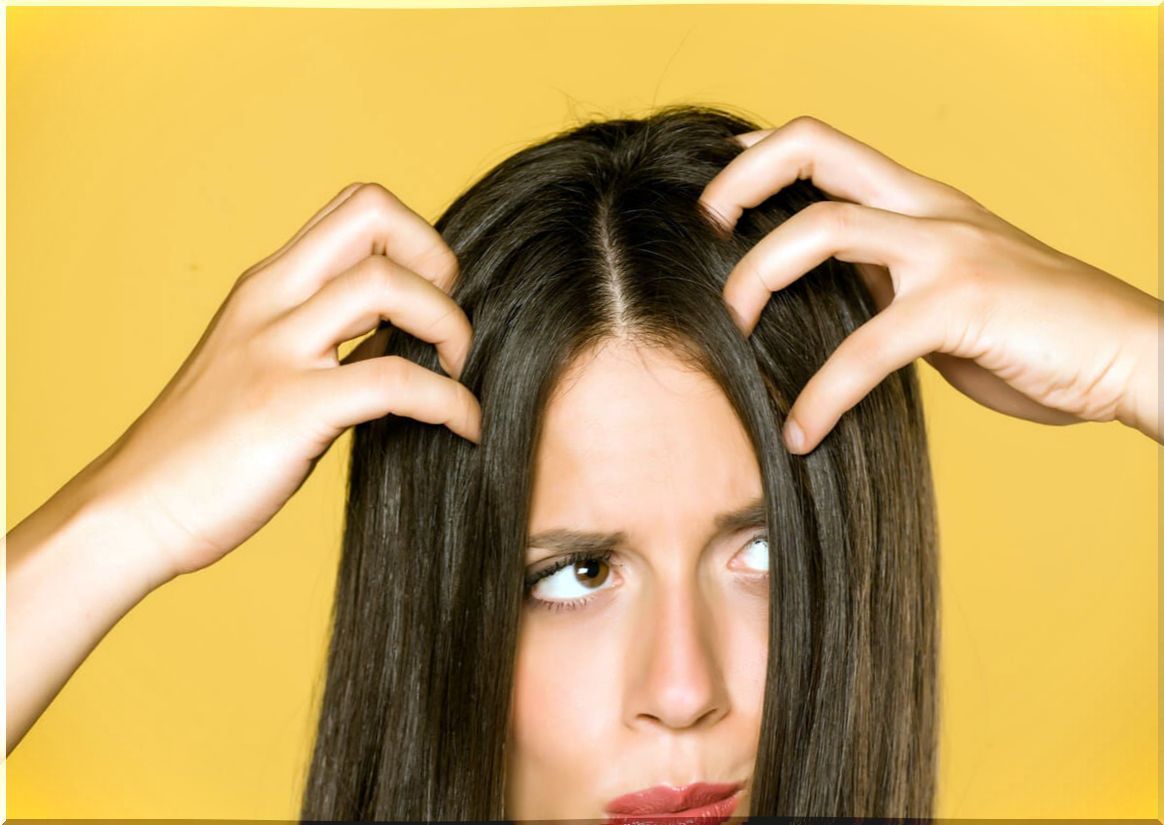 5 home remedies for irritated scalp