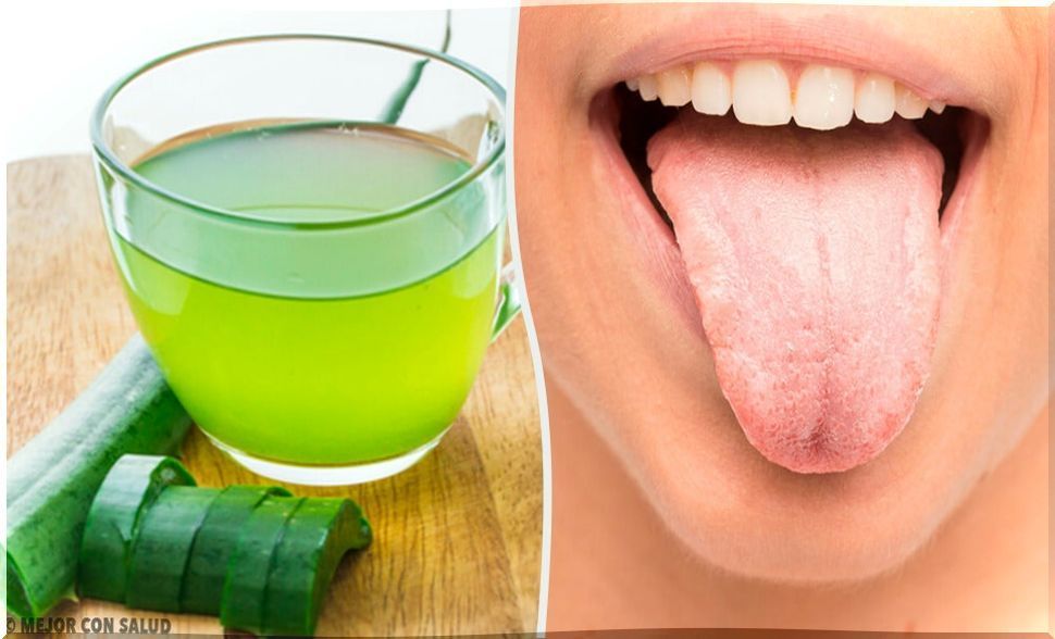 7 natural remedies for white tongue