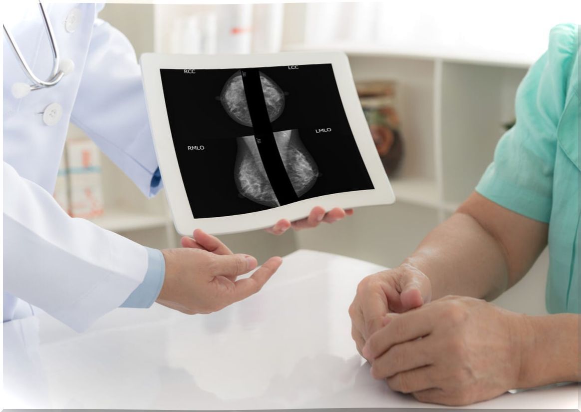 Doctor shows and explains mammogram.