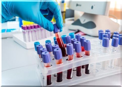 Low neutrophils in the blood.