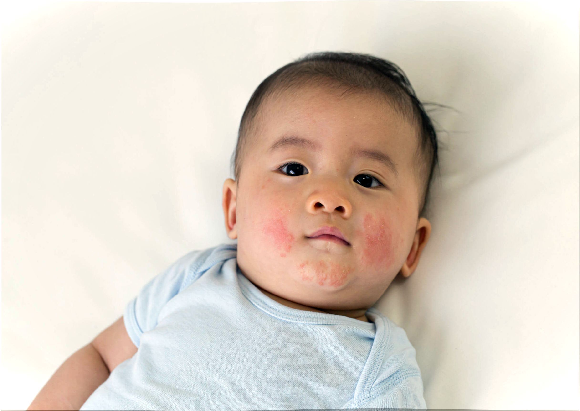 If the baby cries after feeding it may be due to an allergy.