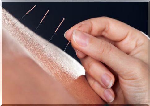 Acupuncture excess hair