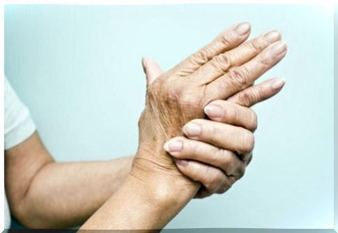 Chronic arthritis