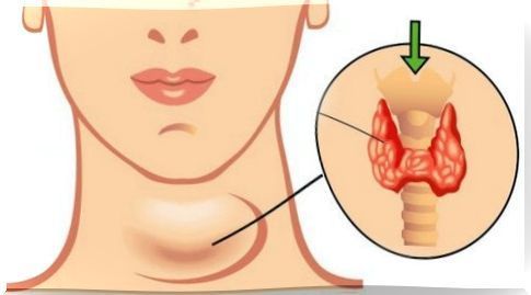 thyroid hormones